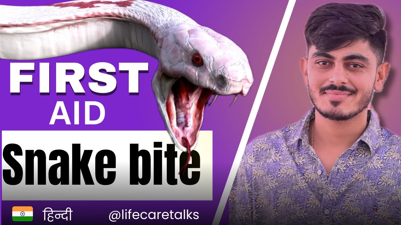 सांप के काटने पर जान कैसे बचें