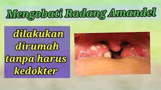 Obat alami radang amandel screenshot 5