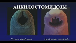 Анкилостомидозы: Анкилостомоз (Ancylostoma duodenale) и Некатороз (Necator americanus)