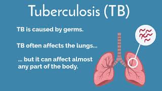 Understanding Tuberculosis: Overview (video 1 of 5)