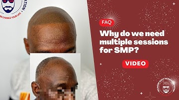 Why Do We Need Multiple Sessions for SMP?