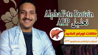 تحليل AFP | نسبة ألفا فيتوبروتين الطبيعية|الاختبارات الأساسية لتشخيص الاصابة بالسرطان| Tumer markers