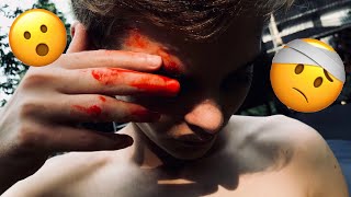 Famous Double Front Flip Progression/tips... ***EASTON BREAKS FACE*** Net Worth