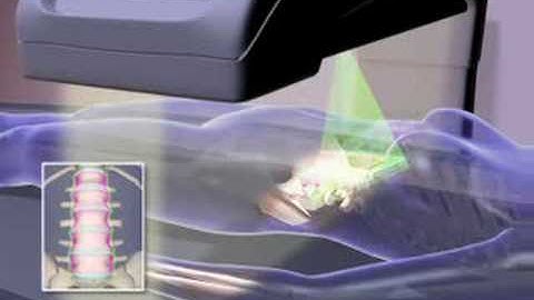 DEXA - Dual Energy X-Ray Absorptiometry