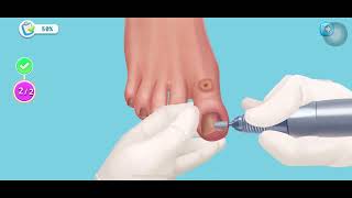 [GAME VUI MẮT] GAME LÀM SẠCH BÀN CHÂN - ĐÃ MẮT screenshot 5