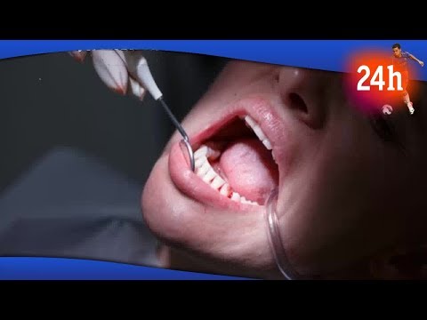 Βίντεο: Μπορούν τα lumineers να επιμηκύνουν τα δόντια;