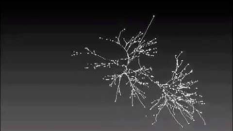 CT Reconstruction-Airway Segmentation 20 mon human