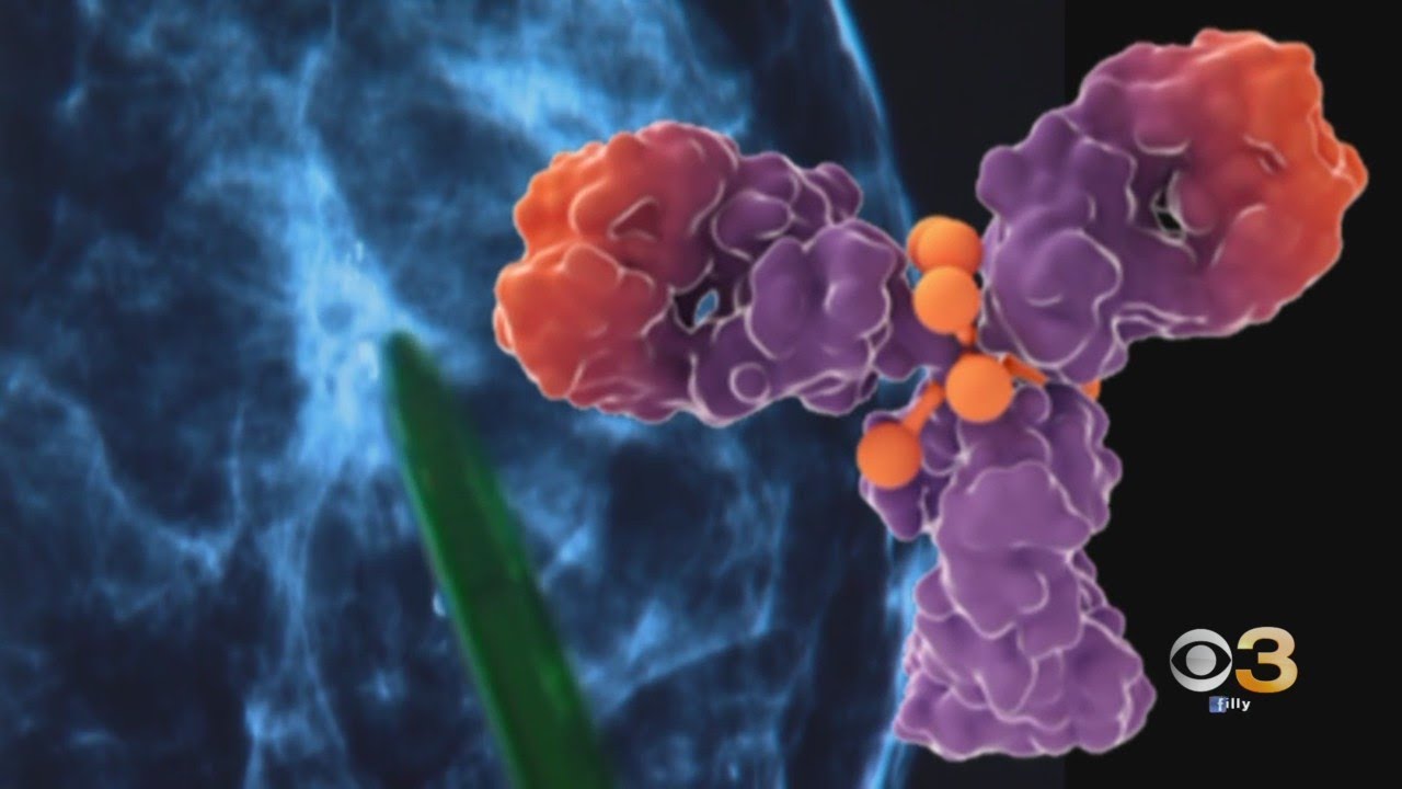 First-Of-Its-Kind Metastatic Breast Cancer Treatment Offering Hope For ...