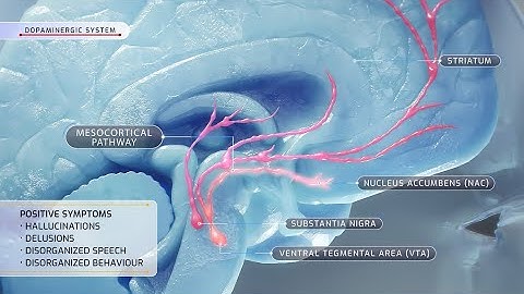 Neural Circuits of Schizophrenia