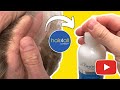 How NOT to Apply Adhesive to a Hair System | Non-Surgical Hair Replacement System Men/Women UK/USA