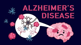 What is Alzheimer’s Disease?