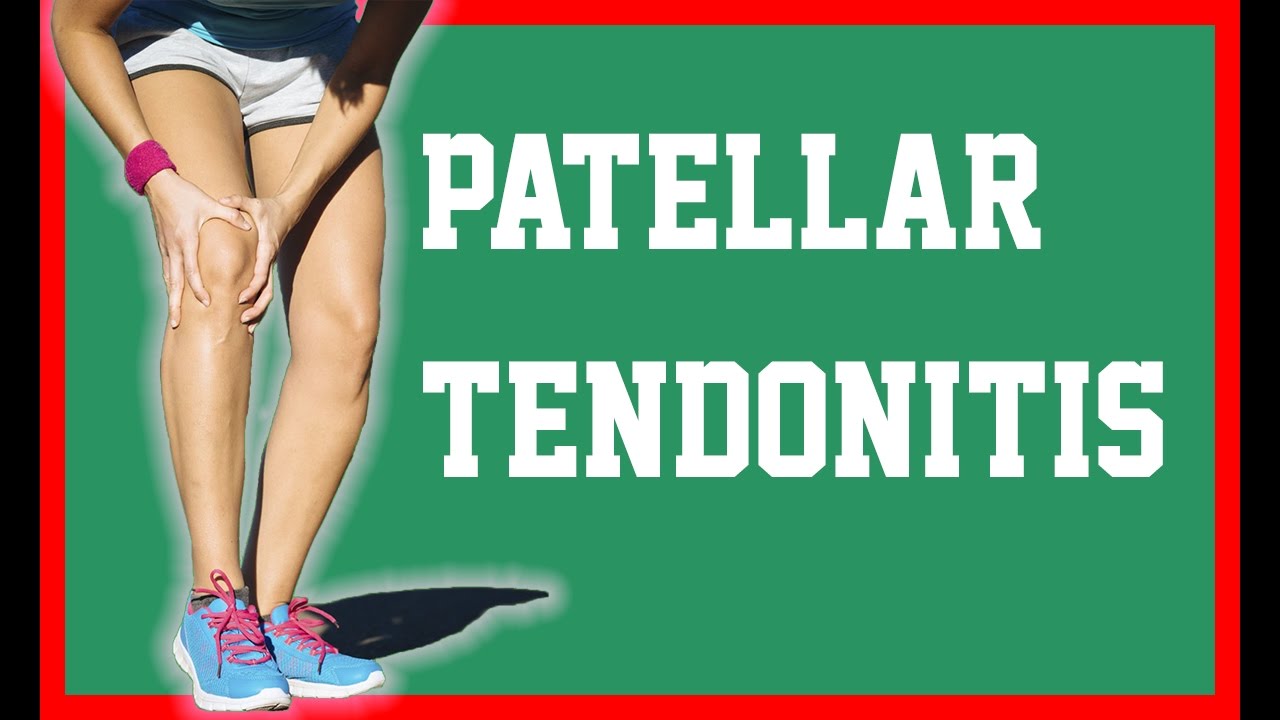 Patellar Tendonitis Golf Patellar Tendonitis NEObracex YouTube