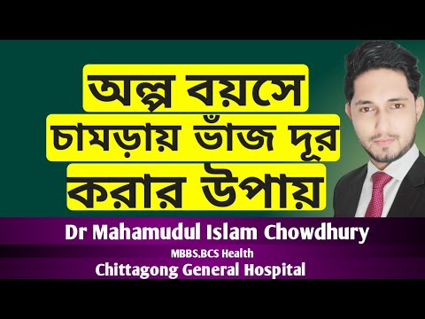 ভিডিও: বাট ডিম্পলস পাওয়ার W টি উপায়