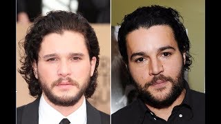 Famous Kit Harington and Christopher Abbott Look So Much Alike, I Don't Know Where to Direct My Bedroom Eye Net Worth