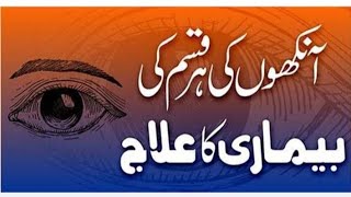 آنکھوں کی بیماری کا علاج | Eye Problem Solution |  Nazar ki kamzori ka Ilaj Urdu Hindi | Eyes Home R