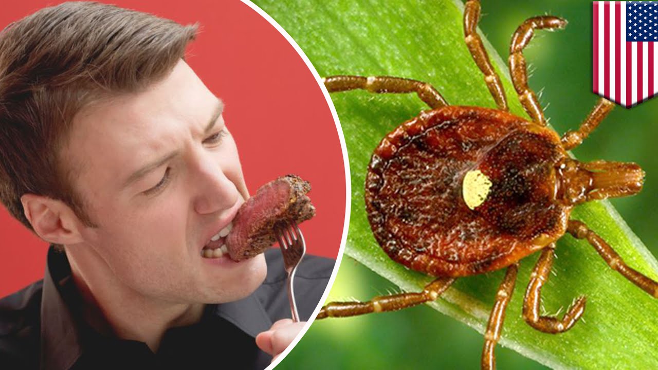 Lone Star tick bites triggering red meat allergies in more people across US, physician says