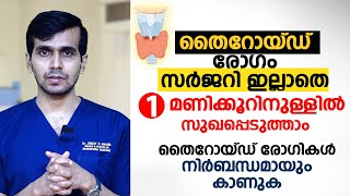 തൈറോയ്ഡ് രോഗം സർജറി ഇല്ലാതെ 1 മണിക്കൂറിനുള്ളിൽ സുഖപ്പെടുത്താം | Thyroid Treatment without SURGERY