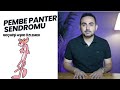 Pembe Panter Sendromu Geçmişi Aşırı Özlemek Üzerine Pembe Panter Sendromu Geçmişi Aşırı Özlemek Üzerine