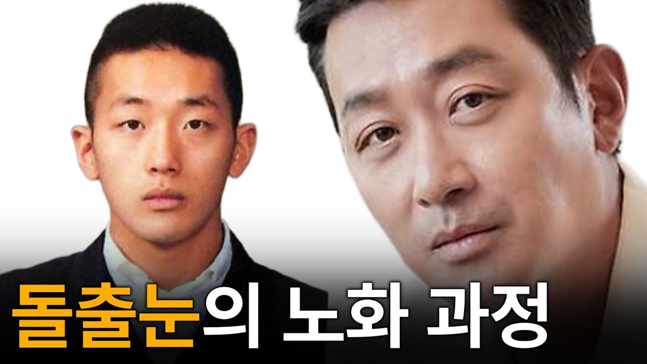 돌출눈의 노화 과정은 어떨까?