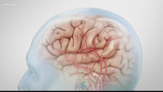 USC researchers seek test subjects to study COVID-19's effect on the brain