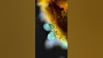 Microscopic Dreams #microlife #aquarium #biology #nature