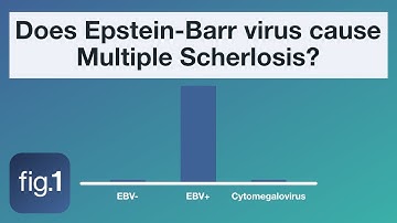 Does Epstein-Barr virus cause multiple sclerosis?