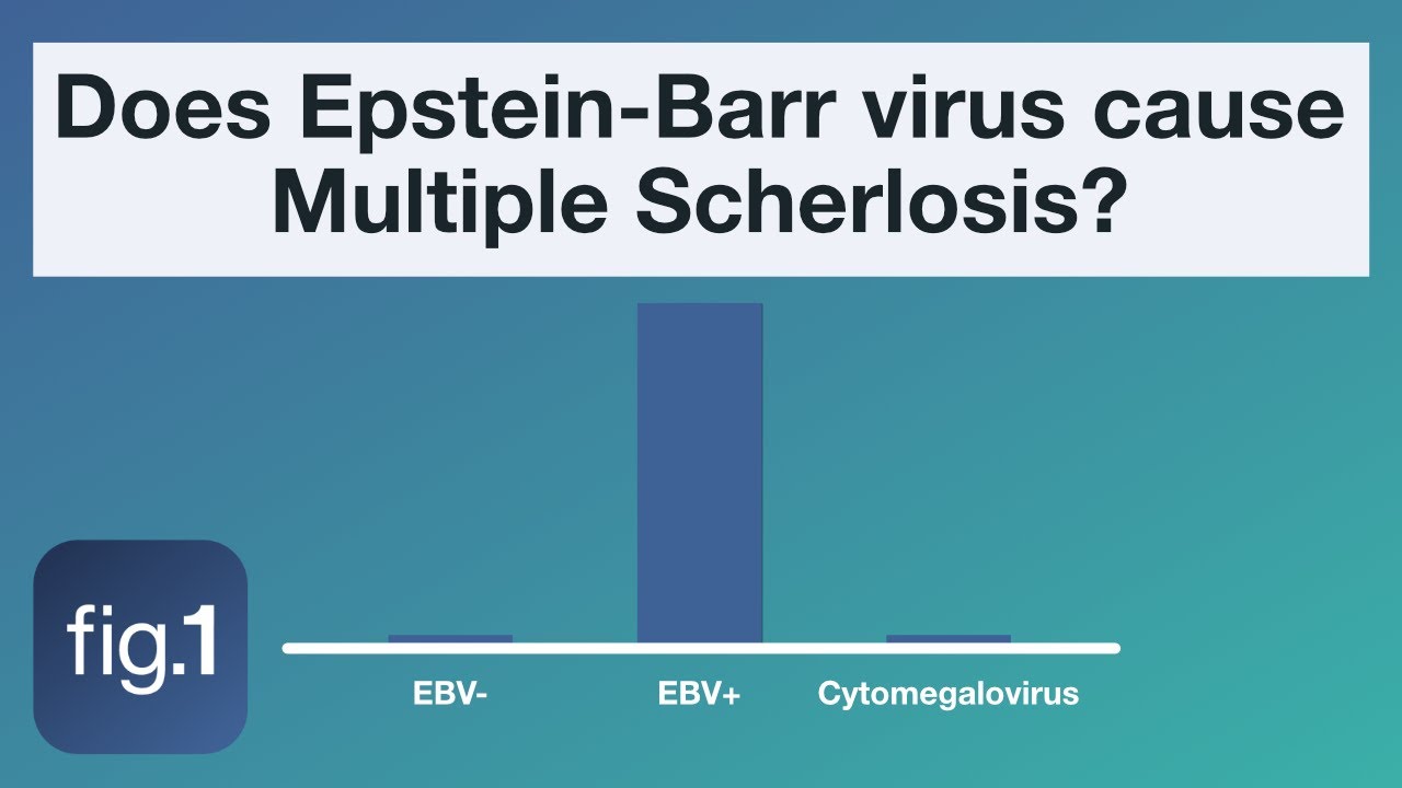 Does Epstein-Barr virus cause multiple sclerosis?