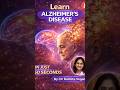 Learn Alzheimer's Disease in just 60 sec by Dr Rushita Vegad