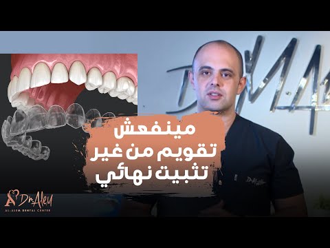 تقويم الاسنان هيفشل لو