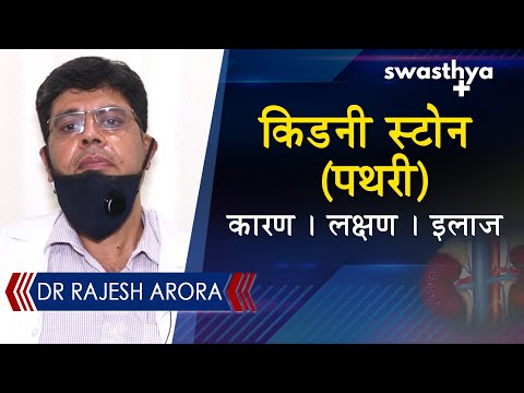 किडनी स्टोन (पथरी) - कारण, लक्षण, इलाज | Dr Rajesh Arora on Kidney Stone in Hindi
