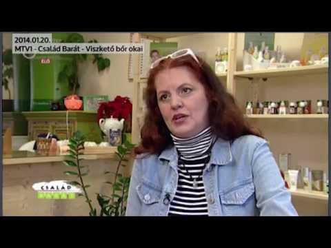 Antal Vali - MTV1/Család barát: A viszkető bőr okai - 2014. 01. 20.