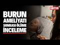 Burun ameliyatı sonrası ölüme ilişkin inceleme başlatıldı