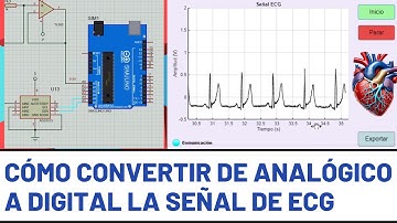 Conversión Analógico Digital de la Señal de Electrocardiograma ECG