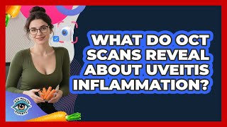 What Do OCT Scans Reveal About Uveitis Inflammation? - Eye Health Experts