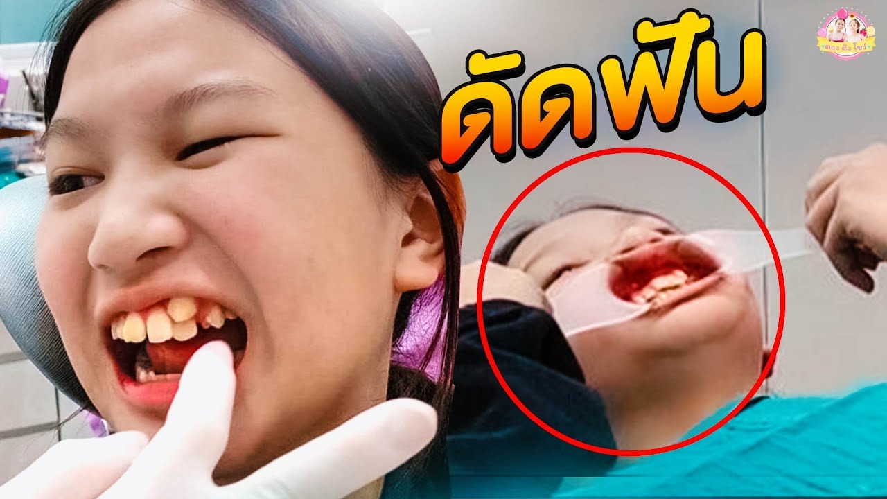 อองตองดัดฟันครั้งแรก สอนวิธีแปรงฟันกับคุณหมอที่ Dental Studio เชียงใหม่❤ ตอง ติง โชว์ ❤
