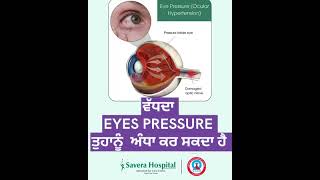 ਵੱਧਦਾ Eye Pressure ਖਤਰਨਾਕ ਕਿਉਂ ਹੈ? 👁️ Best Eye Hospital in Moga ਤੋਂ ਜਾਣੋ Blindness ਦਾ Secret