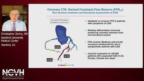 Dr. Christopher Zarins, Critical Limb Threatening Ischemia