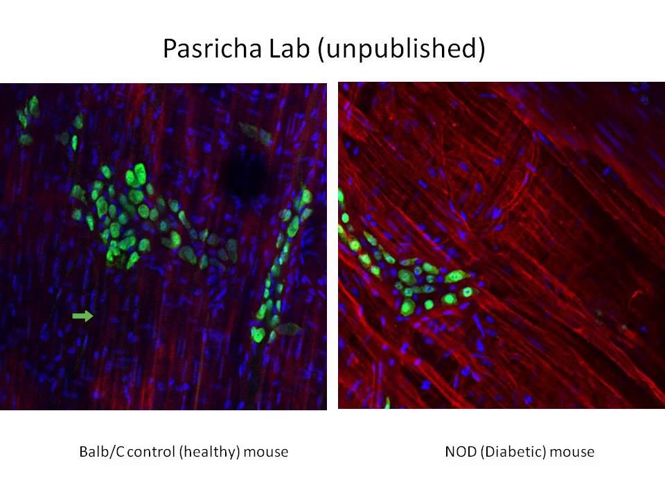 Webinar: GI Complications and Treatments in Scleroderma, with Dr. Pankaj “Jay” Pasricha (2013)