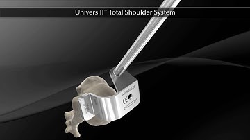 Univers II™ Total Shoulder System