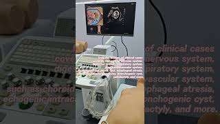 Ultrasound simulation training system (Obstetrics)