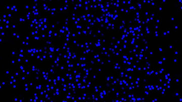 Expanding vection stimulus