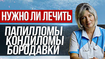 Папилломы, кондиломы и бородавки. Отчего возникают и надо ли их лечить? Вирус папилломы