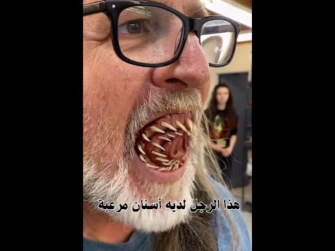  الأسنان المرعبة