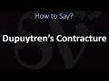 How to Pronounce Dupuytren’s Contracture? (CORRECTLY)