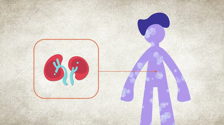 High Potassium (Hyperkalemia) - Symptoms & Causes | National Kidney Foundation - DayDayNews