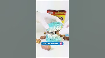 Niềng răng nên ăn Snack gì? #nhakhoahanoisydney #niengrang #shorts