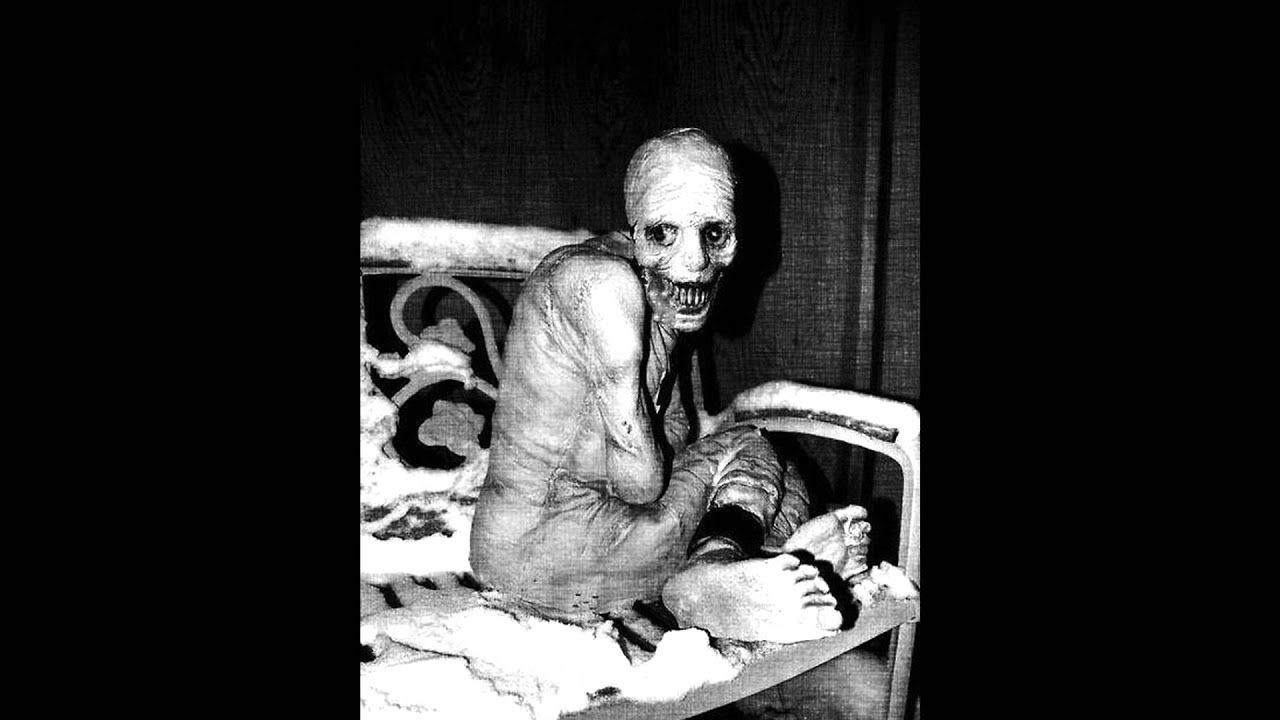 Lesch-Nyhan - Septic Hole (Lesch-Nyhan - Lesch-Nyhan Syndrome) - YouTube