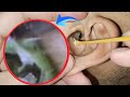 Horror Doctor ASMR | Emergency Ear Cleaning From Infected Canal | Real Ear Sounds | EP 215