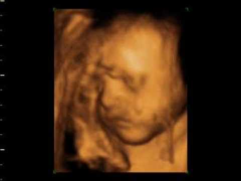 lisa matthew 4d baby scan