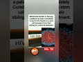 🧬🚨 breaking news: norway patient cured of hiv after stem cell transplant from sibling.#Shorts"